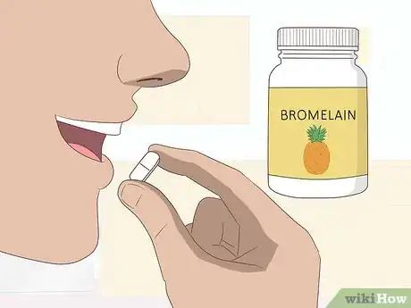Imagen titulada Make a Bruise Go Away Faster Step 16