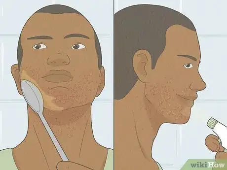 Imagen titulada Get Rid of Razor Burn Fast Step 3