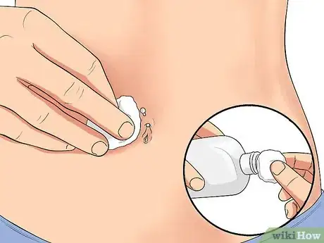 Imagen titulada Treat an Irritated Belly Button Piercing Step 1