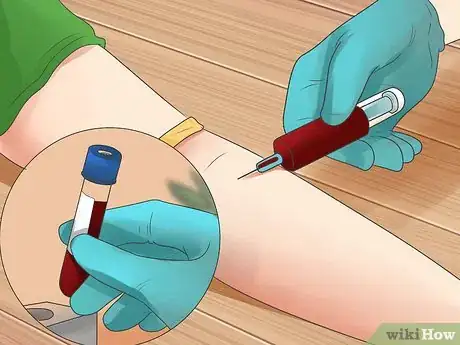 Imagen titulada Test for Kidney Disease Step 2