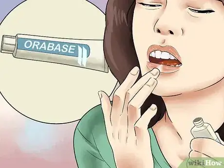 Imagen titulada Heal Mouth Inflammation Step 8