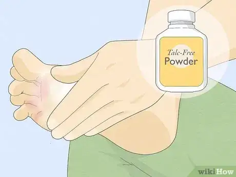 Imagen titulada Heal Raw Skin Step 4