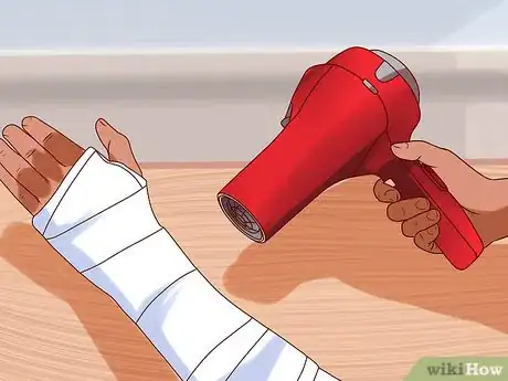 Imagen titulada Scratch Under Your Cast Step 1