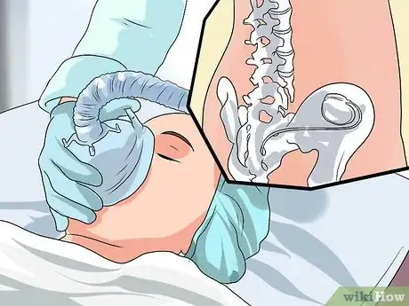 Imagen titulada Manage Bedwetting in College Step 8