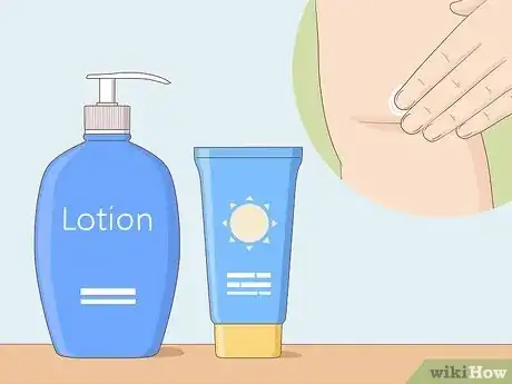 Imagen titulada Remove Spider Veins Step 6