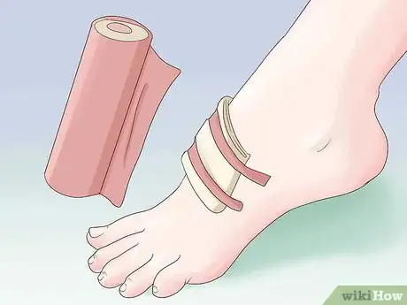 Imagen titulada Get Rid of a Scab Step 1