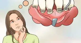detener el picor de las encías