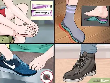 Imagen titulada Prevent Foot Blisters Step 12