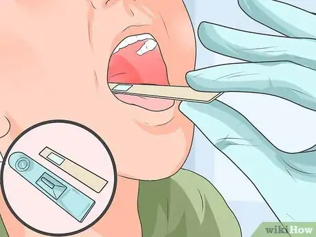 Imagen titulada Take a Throat Culture Step 7