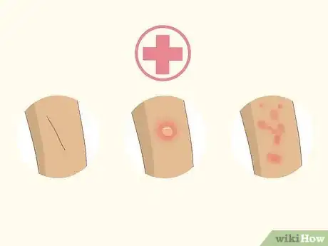 Imagen titulada Apply K‐Y Jelly Step 10