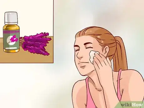 Imagen titulada Get Rid of Acne Scars Naturally Step 6