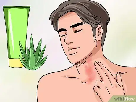 Imagen titulada Heal Chafed Skin Step 5