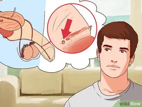 Imagen titulada Tell Signs of Sexual Infection from Penis Step 15