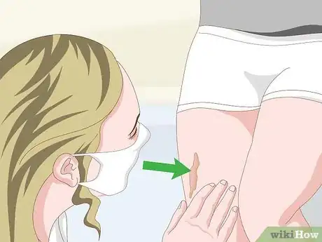 Imagen titulada Get Rid of Scars Step 7