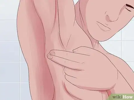 Imagen titulada Check a Wound for Infection Step 17