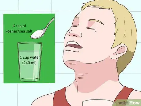 Imagen titulada Reduce Tongue Swelling Step 5
