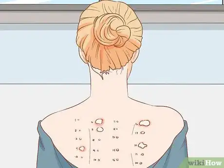 Imagen titulada Deal with Nipple Eczema Step 7