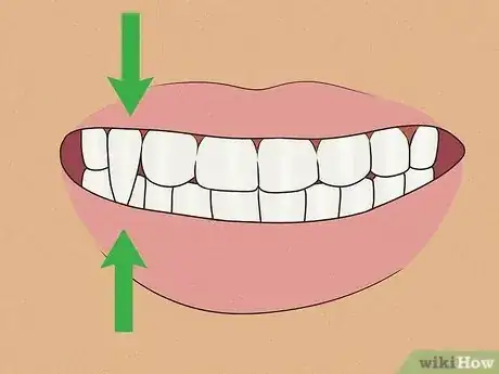Imagen titulada Make Quick Vampire Fangs Step 7.jpeg