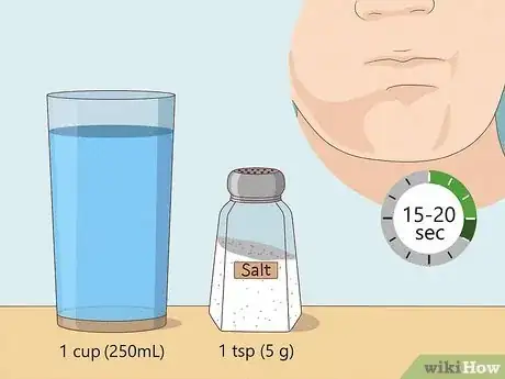 Imagen titulada Heal a Bitten Tongue Step 8