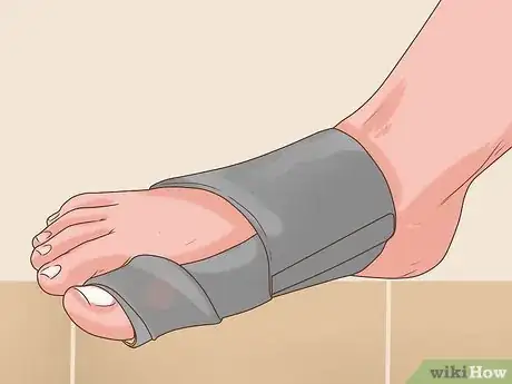 Imagen titulada Treat Bunions Naturally Step 5