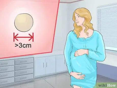 Imagen titulada Check a Cervix for Dilation Step 8