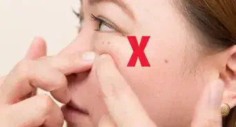 eliminar el acné usando hojas de menta