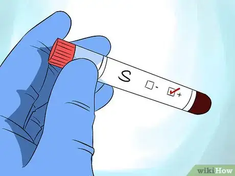 Imagen titulada Get Tested for STDs Step 11