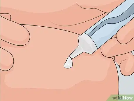 Imagen titulada Remove Scars on Legs Step 13