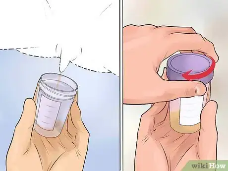 Imagen titulada Help a Male Child Provide a Urine Sample Step 25