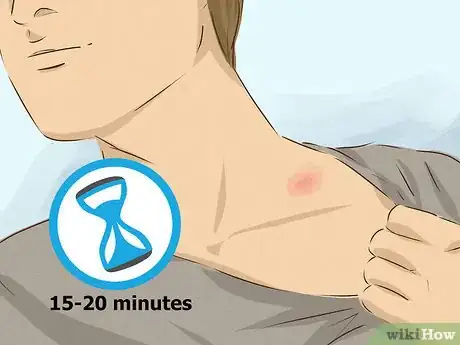 Imagen titulada Hide a Hickey Step 9