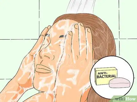 Imagen titulada Avoid Eyebrow Piercing Scars Step 6