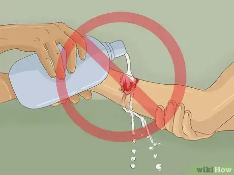 Imagen titulada Treat a Rattlesnake Bite Step 17