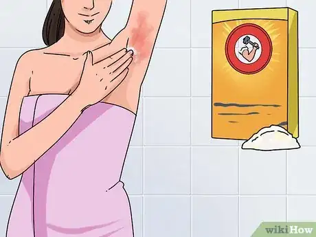 Imagen titulada Heal Chafed Skin Step 2
