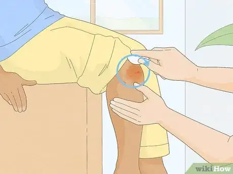 Imagen titulada Remove Iodine Stains from Skin Step 3