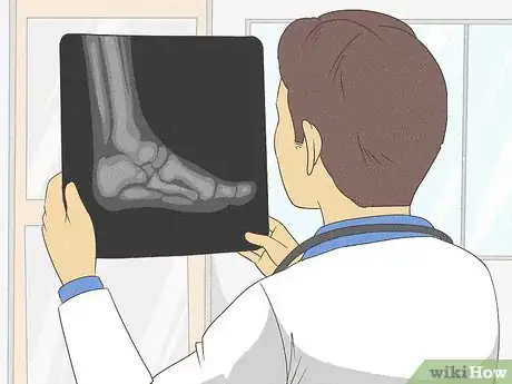 Imagen titulada Fix Flat Feet Step 9