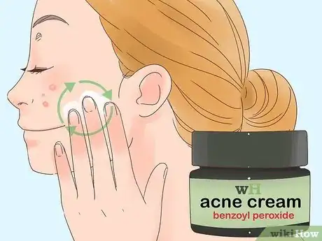 Imagen titulada Remove the Redness of a Pimple Step 9