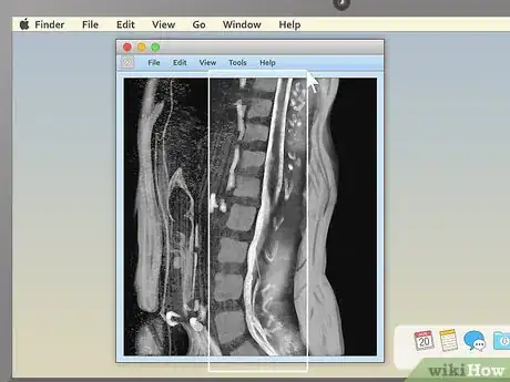 Imagen titulada Read an MRI Step 12