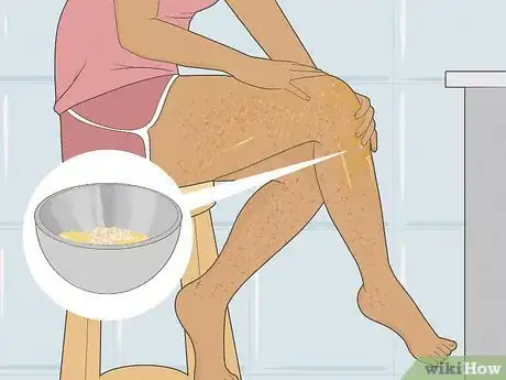 Imagen titulada Get Rid of Razor Burn Fast Step 2