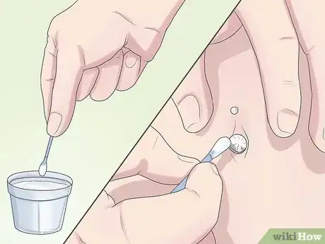 Imagen titulada Clean Navel Piercings Step 3