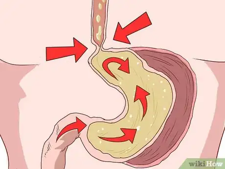 Imagen titulada Know if You Have Laryngitis Step 16
