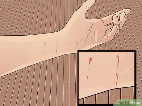 Imagen titulada Treat a Cat Bite Step 1