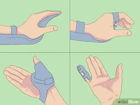 Imagen titulada Splint a Fractured Hand Step 3