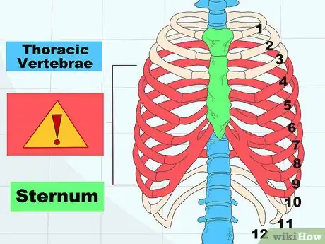 Imagen titulada Assess a Rib Fracture Step 1