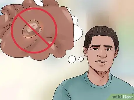 Imagen titulada Treat a Corn or Callus Step 15