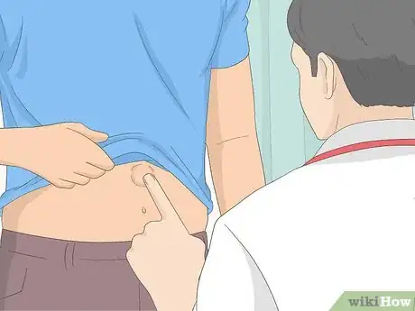 Imagen titulada Treat a Hernia at Home Step 10