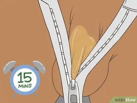 Imagen titulada Free a Penis from a Stuck Zipper Step 12