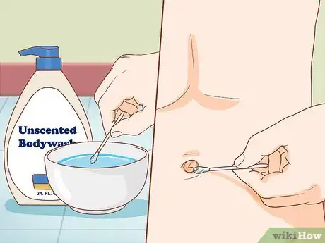 Imagen titulada Clean Your Belly Button Step 3