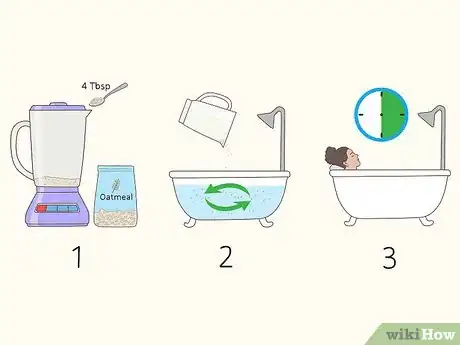 Imagen titulada Get Rid of Back Acne Scars Step 8