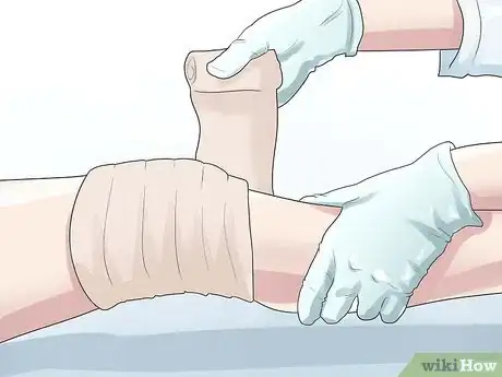 Imagen titulada Know if You Have a Baker's Cyst Step 11