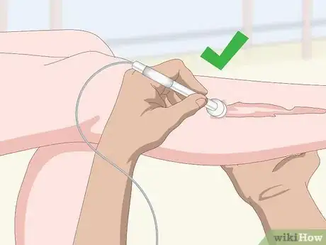 Imagen titulada Get Rid of Scars Step 9